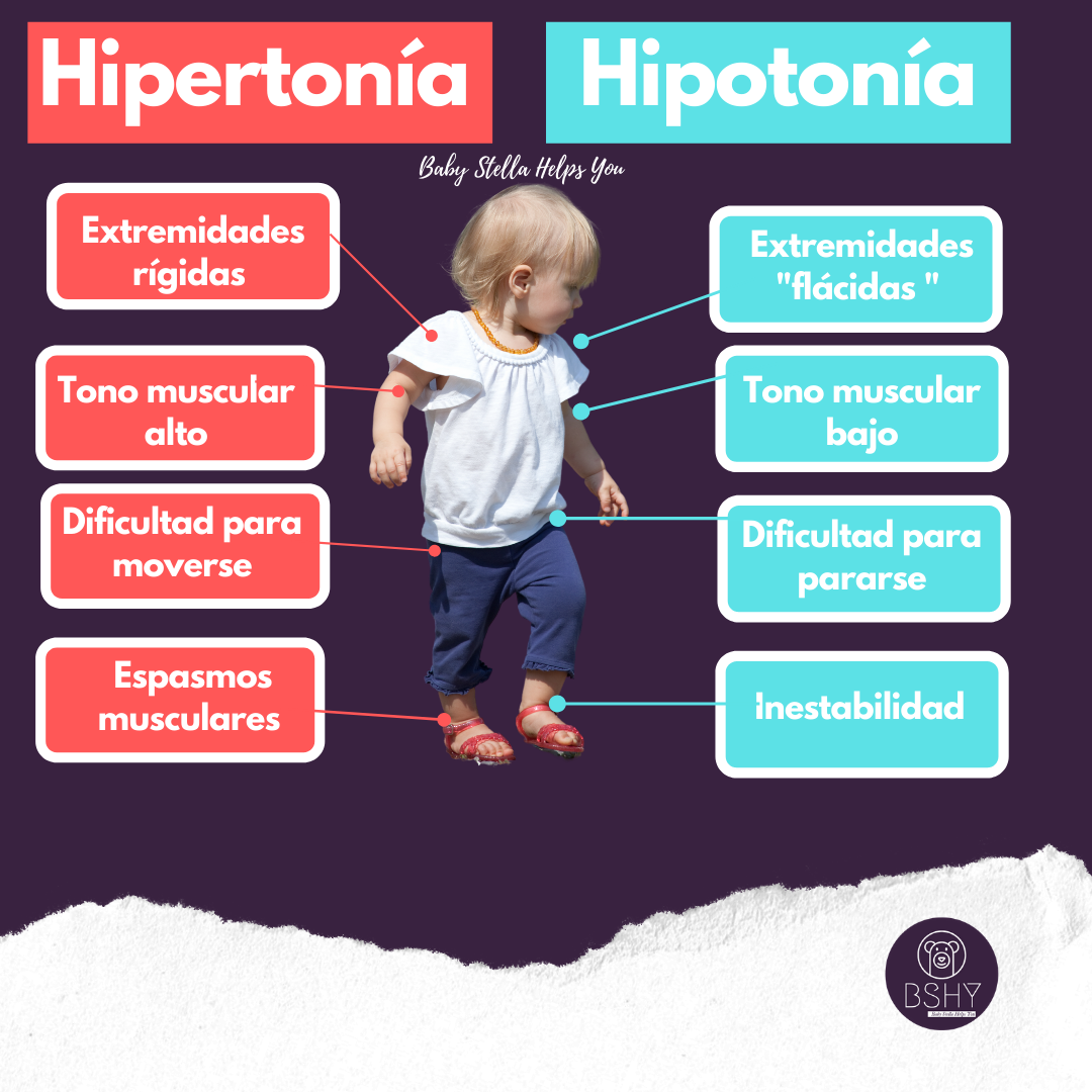 Saiba Como Identificar Os Tipos De Hipertonia Muscular – QOLOAA